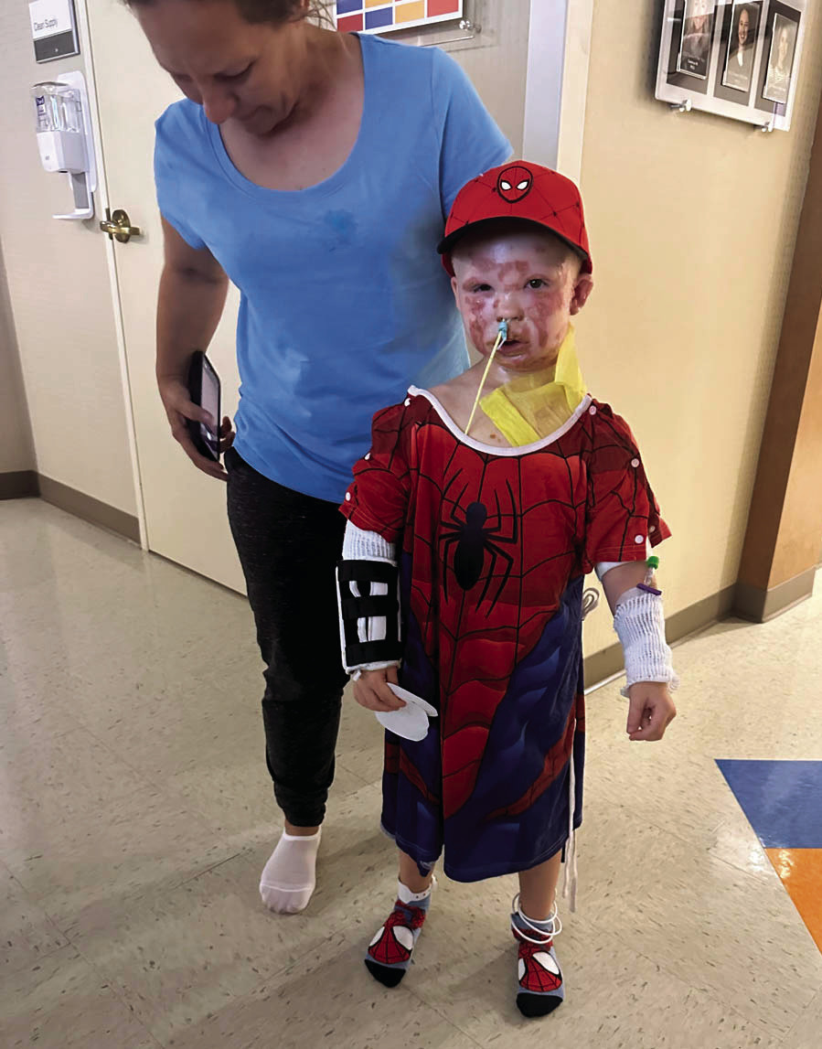 Ryker Corona, dressed in a Spiderman costume, takes a walk at Integris Baptist Hospital in Oklahoma City where he is undergoing treatment for second degree burns he sustained in an explosion at the Jasmine Moran Children’s Museum on Saturday, June 21. (