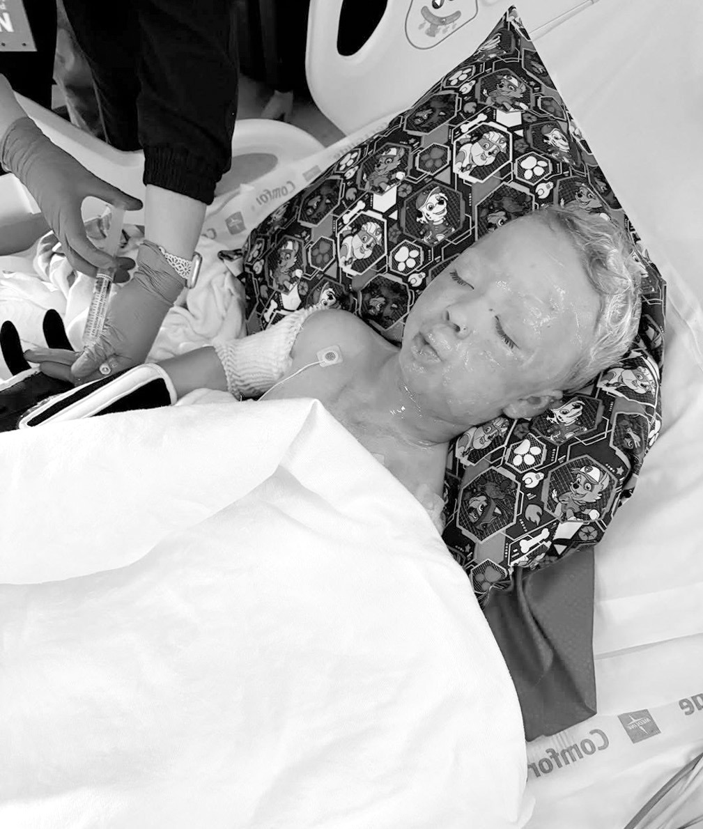 Four-year-old Ryker Corona suffered second degree burns on his face, chest and arms in an explosion at the Jasmine Moran Children’s Museum Saturday, June 21. Ryker underwent surgery in Oklahoma City yesterday. —Photo courtesy the Corona family