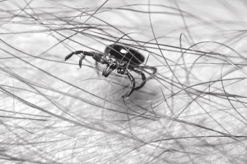 How to Treat a Tick Bite And When to See a Doctor